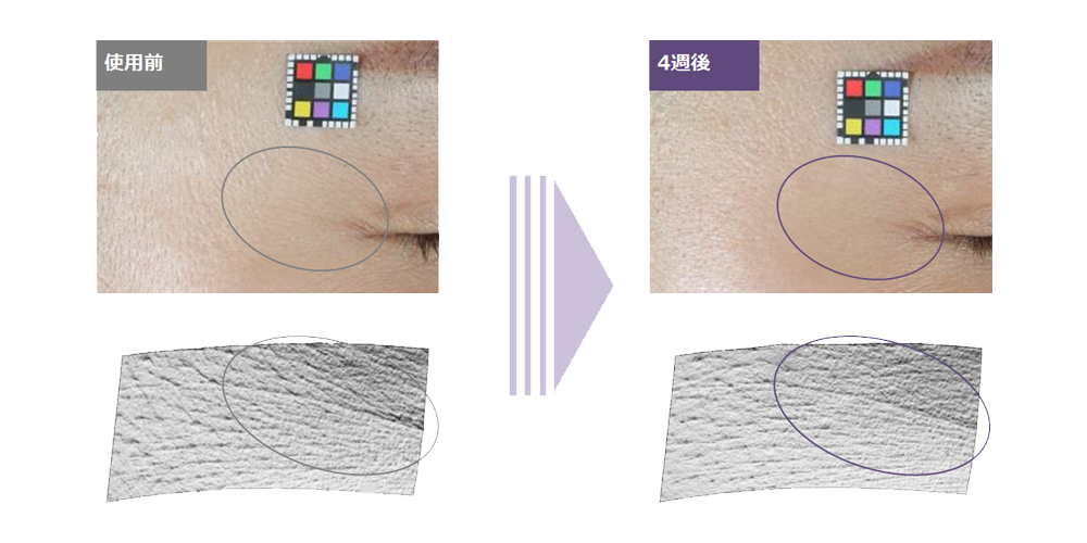 2.シワ改善効果